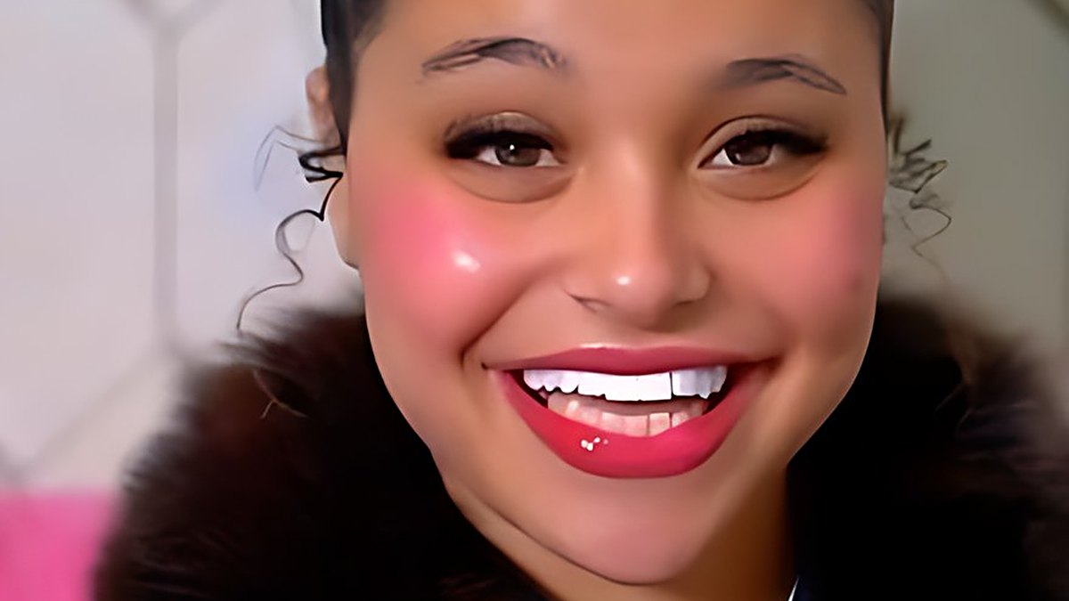 ابتسامة برينسيسا الطنجاوية بعد Snap-on Smile عند Labo Ahlam